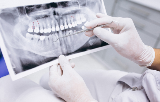 Cirugía oral y maxilofacial