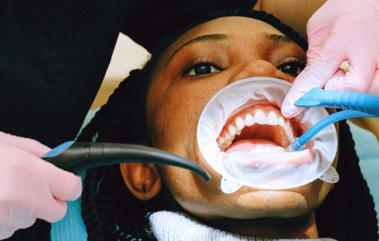Rehabilitacion Oral