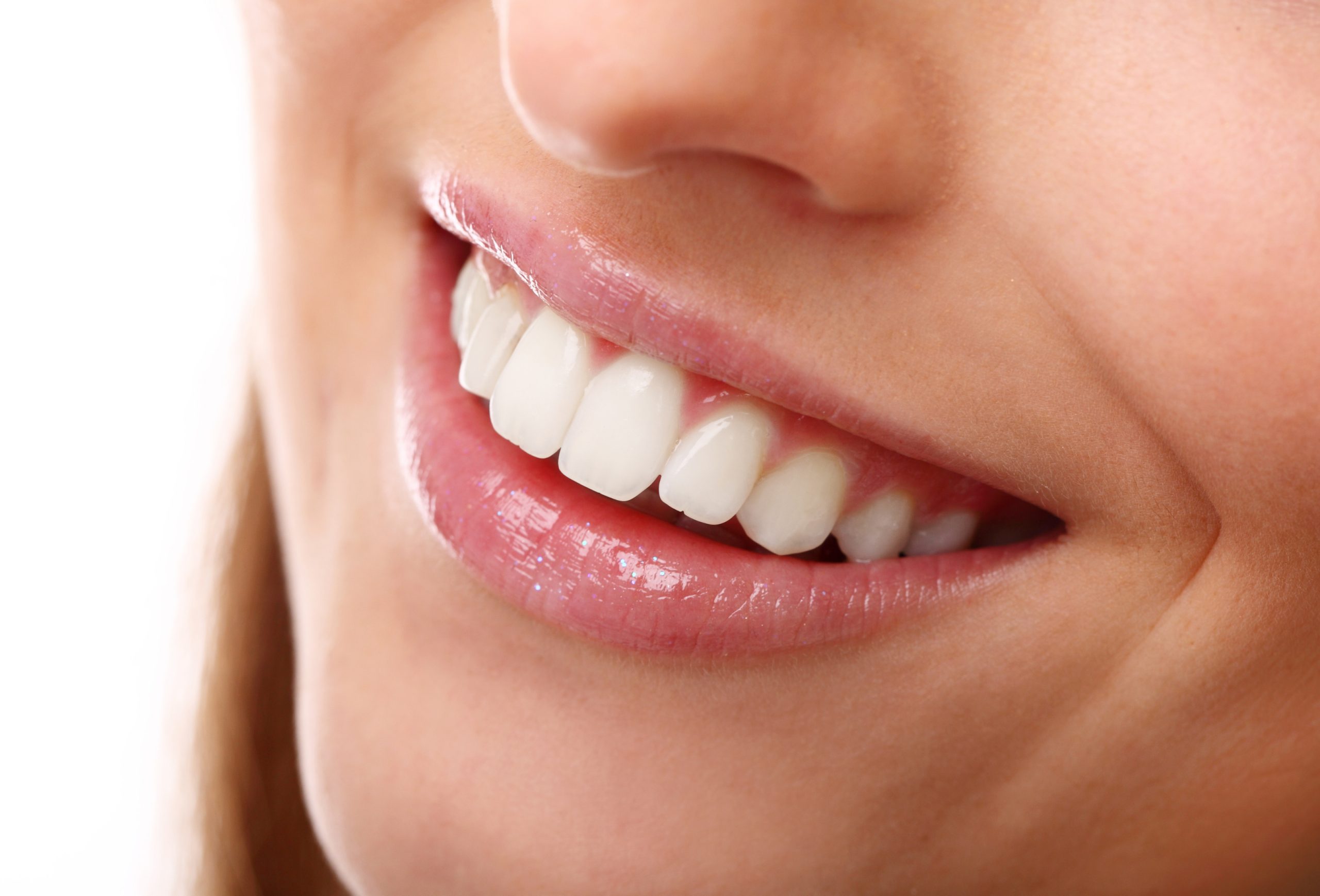 Diseño de sonrisa costo y duración