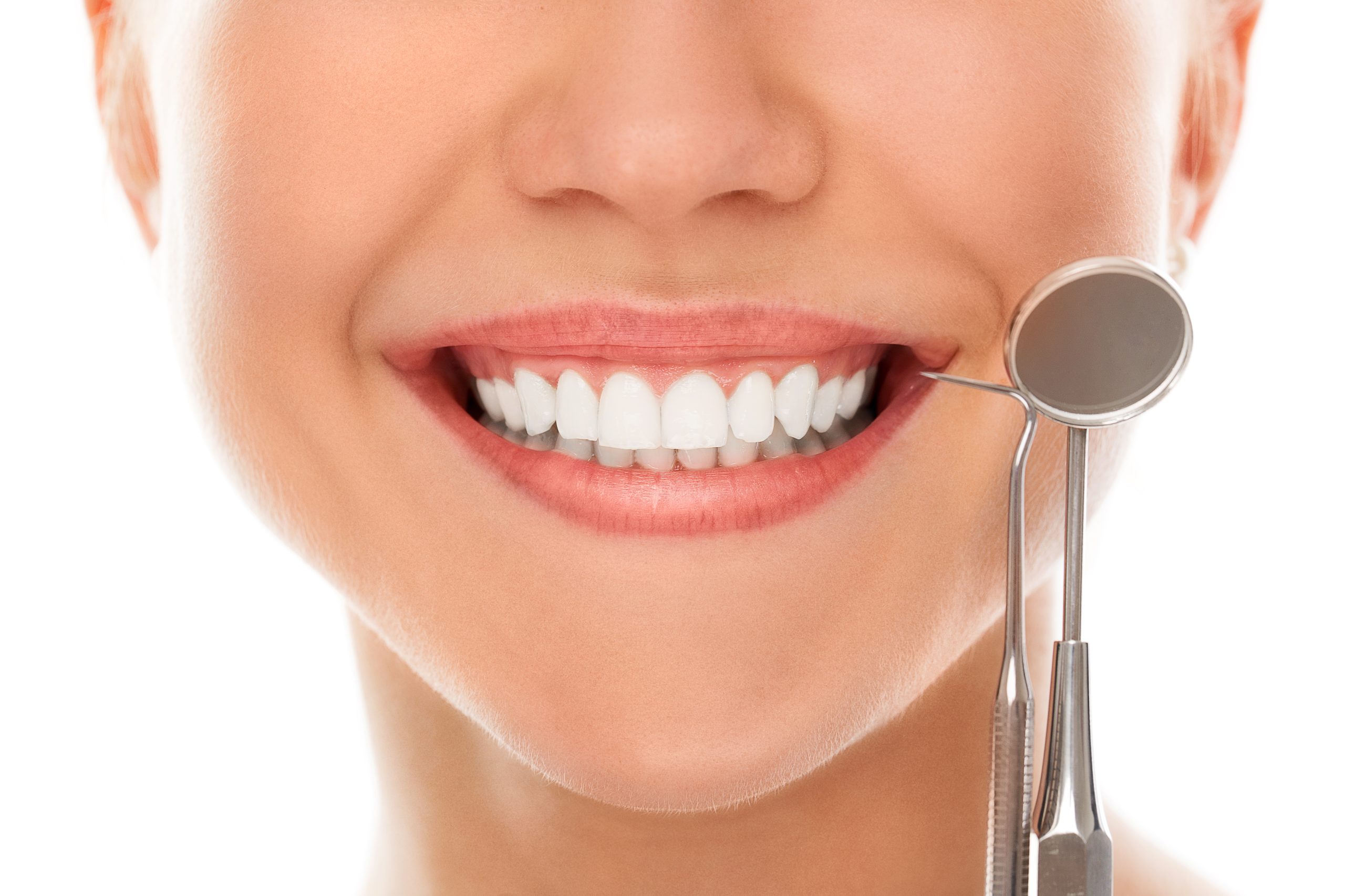 Top 2 mejores Carillas dentales y sus resultados