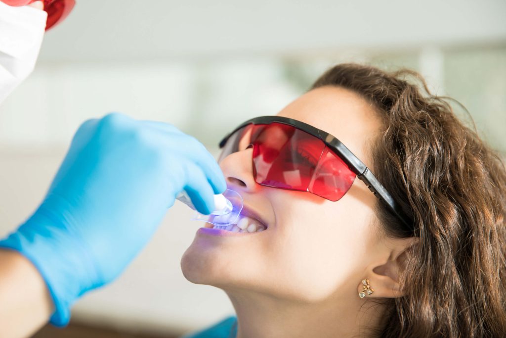 blanqueamiento dental