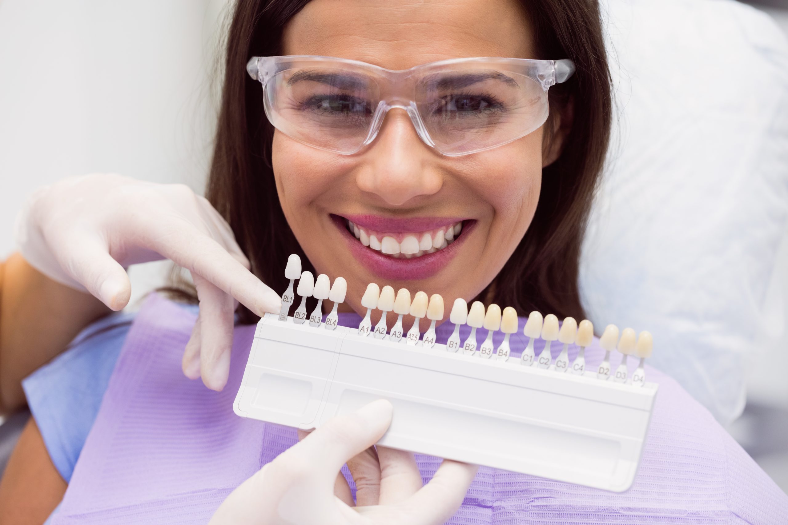 Tipos de carillas dentales
