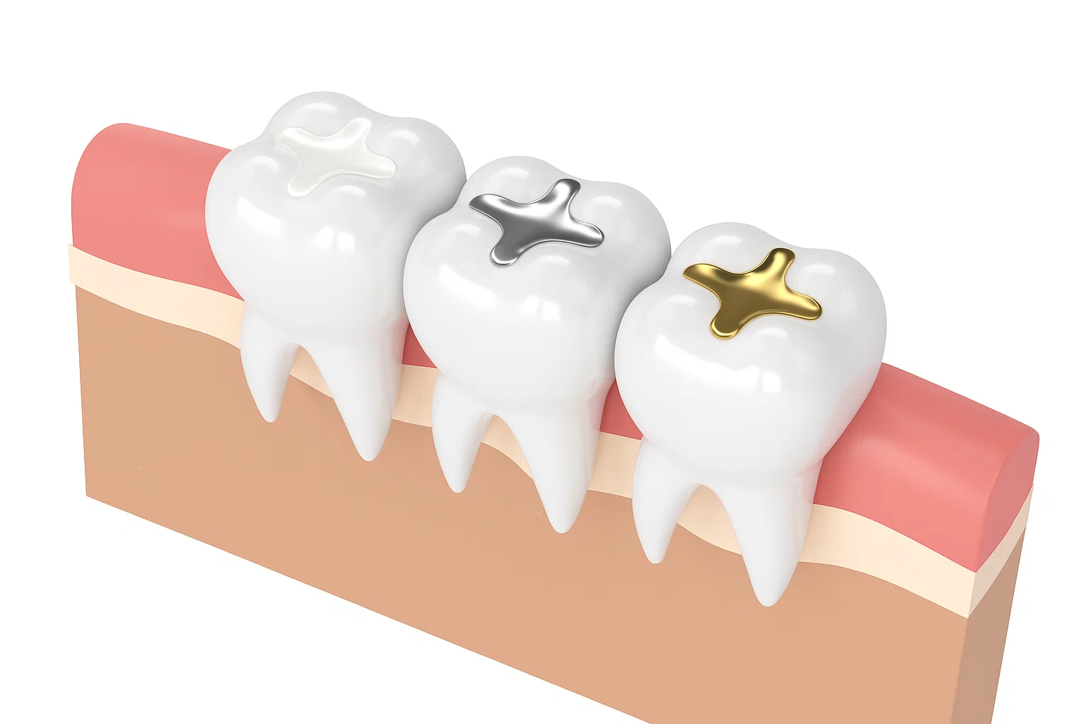 calza dental
