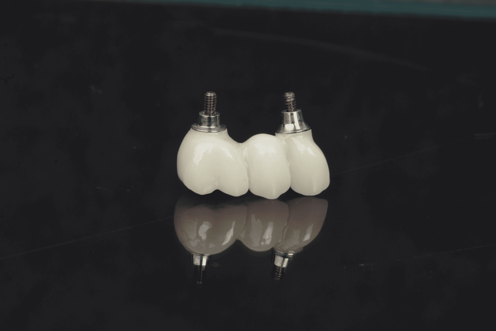 Cuánto cuesta un implante dental