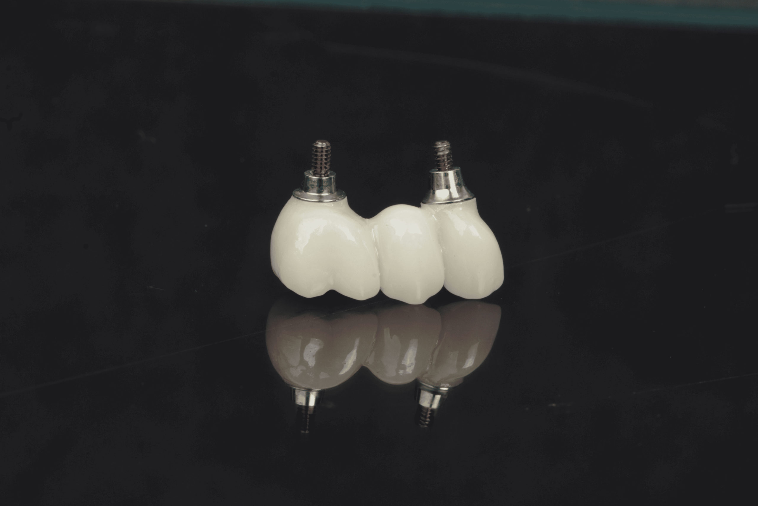 Cuánto cuesta un implante dental