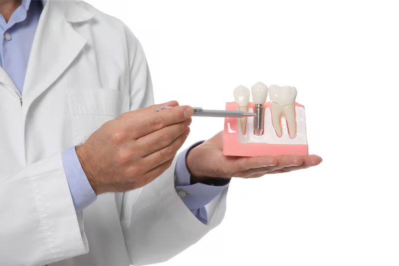 Tipos de implantes dentales