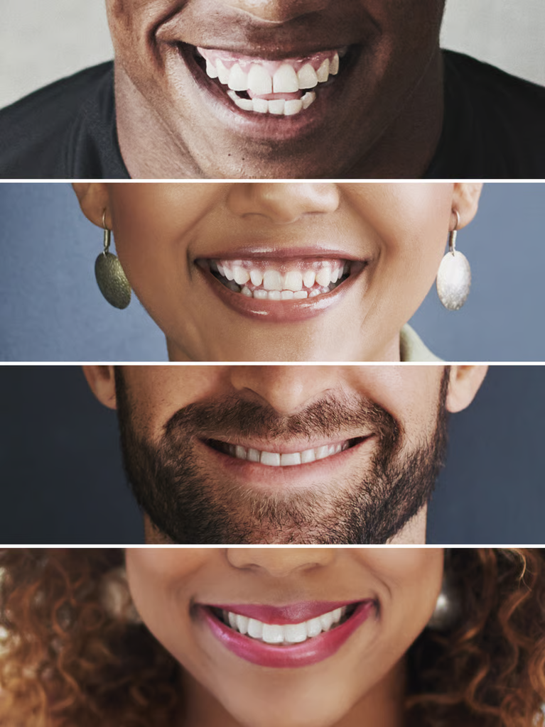 cuánto cuesta un diseño de sonrisa