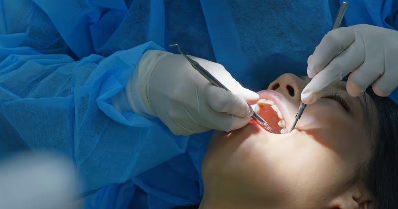 Gingivectomía