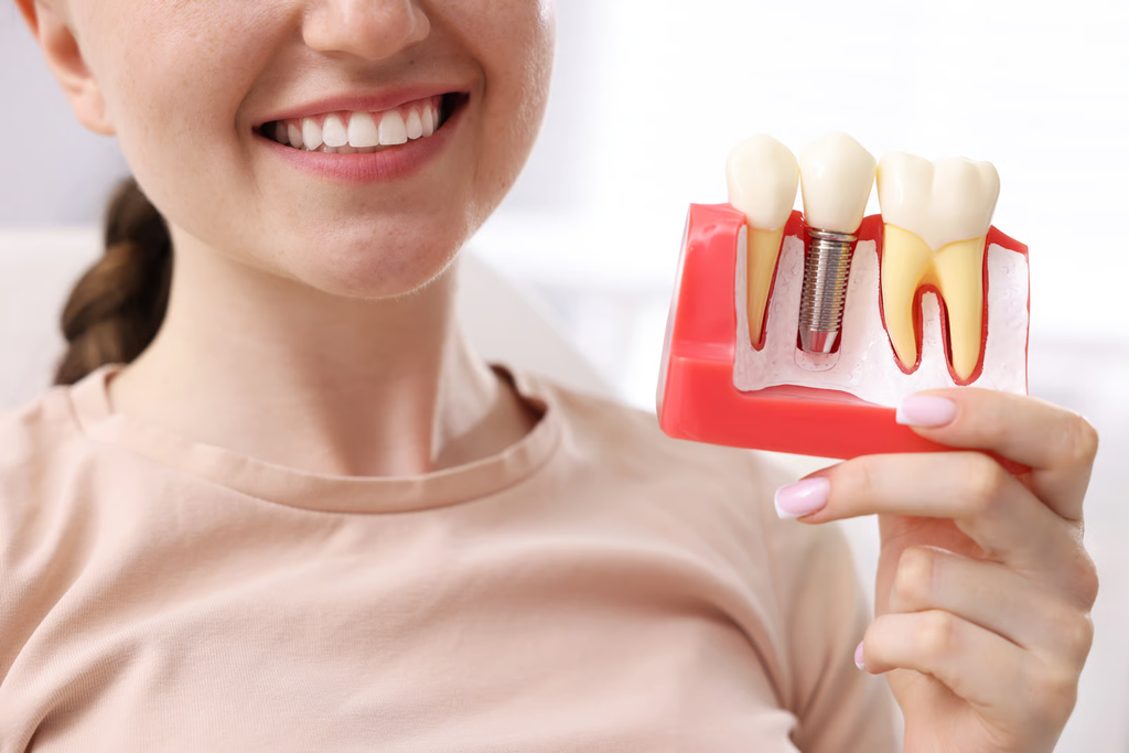 Tipos de implantes dentales