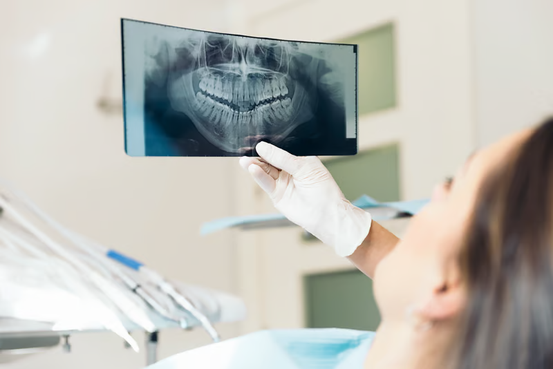 Cuánto cuesta un implante dental
