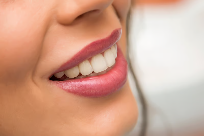 Cuanto cuesta un diseño de sonrisa