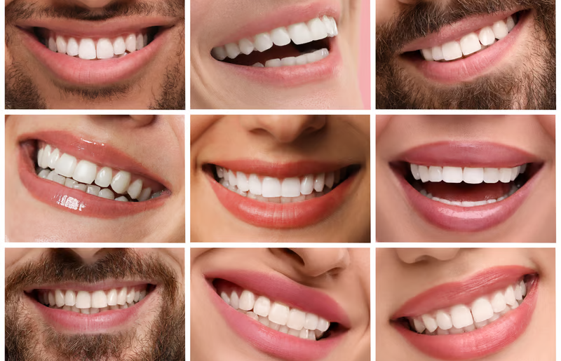 Estética dental